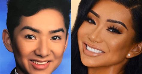 nikita dragun before surgery|Nikita Dragun Pre